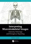 Interpreting Musculoskeletal Images cover