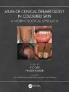 Atlas of Clinical Dermatology in Coloured Skin cover