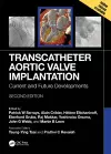 Transcatheter Aortic Valve Implantation cover