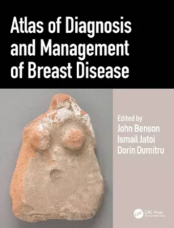 Atlas of Diagnosis and Management of Breast Disease cover