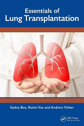 Essentials of Lung Transplantation cover