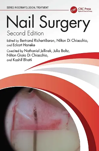 Nail Surgery cover