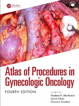 Atlas of Procedures in Gynecologic Oncology cover