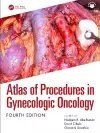 Atlas of Procedures in Gynecologic Oncology cover