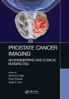 Prostate Cancer Imaging cover