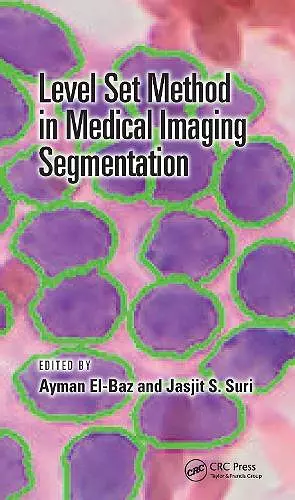 Level Set Method in Medical Imaging Segmentation cover