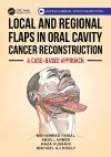 Local and Regional Flaps in Oral Cavity Cancer Reconstruction cover