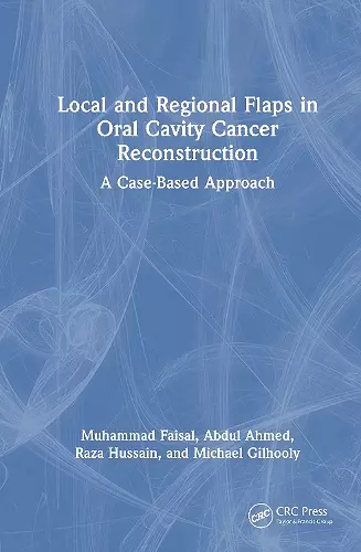 Local and Regional Flaps in Oral Cavity Cancer Reconstruction cover