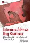 Cutaneous Adverse Drug Reactions cover