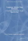 Cutaneous Adverse Drug Reactions cover