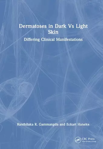 Dermatoses in Dark Vs Light Skin cover