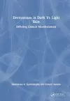 Dermatoses in Dark Vs Light Skin cover