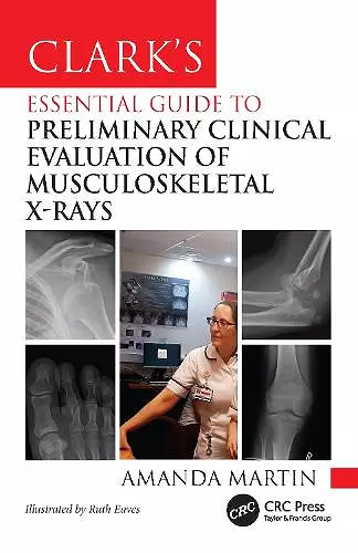 Clark’s Essential Guide to Preliminary Clinical Evaluation of Musculoskeletal X-rays cover