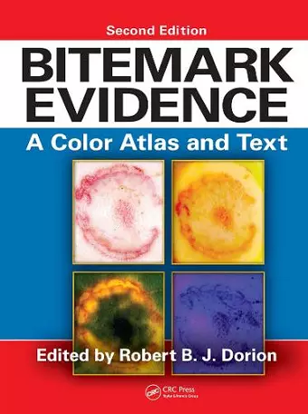 Bitemark Evidence cover