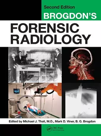 Brogdon's Forensic Radiology cover