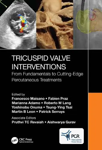 Tricuspid Valve Interventions cover