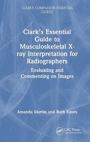 Clark’s Essential Guide to Preliminary Clinical Evaluation of Musculoskeletal X-rays cover