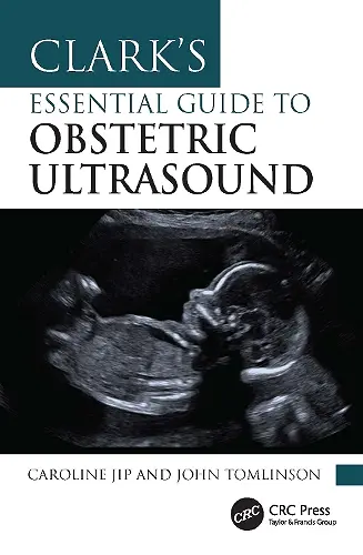 Clark's Essential Guide to Obstetric Ultrasound cover