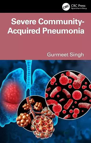 Severe Community Acquired Pneumonia cover