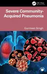 Severe Community-Acquired Pneumonia cover
