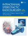 Intracranial Stereotactic Radiosurgery cover