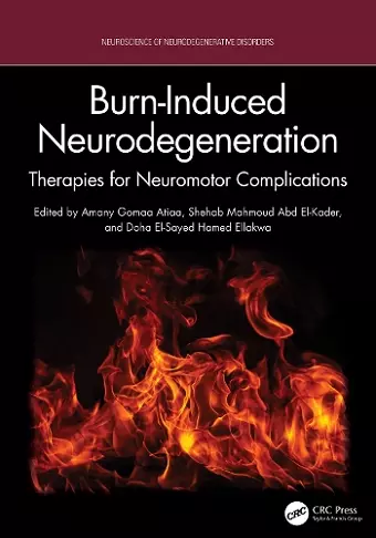 Burn-Induced Neurodegeneration cover