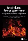 Burn-Induced Neurodegeneration cover