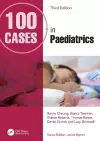 100 Cases in Paediatrics cover