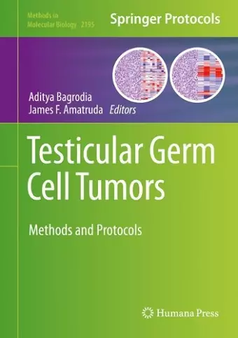 Testicular Germ Cell Tumors cover