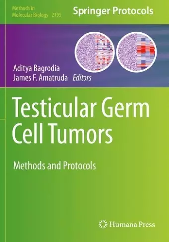 Testicular Germ Cell Tumors cover