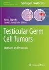 Testicular Germ Cell Tumors cover
