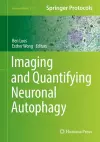 Imaging and Quantifying Neuronal Autophagy cover