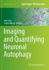 Imaging and Quantifying Neuronal Autophagy cover