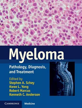 Myeloma cover