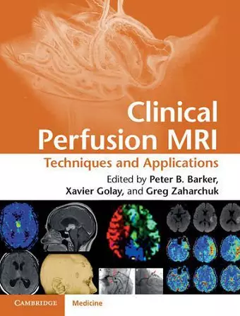 Clinical Perfusion MRI cover