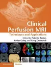 Clinical Perfusion MRI cover