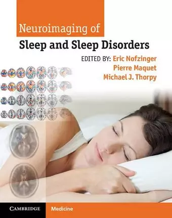 Neuroimaging of Sleep and Sleep Disorders cover