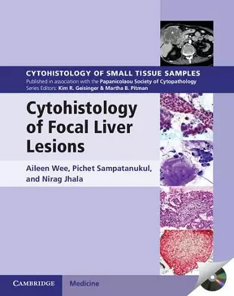 Cytohistology of Focal Liver Lesions cover