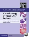 Cytohistology of Focal Liver Lesions cover