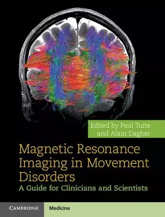 Magnetic Resonance Imaging in Movement Disorders cover