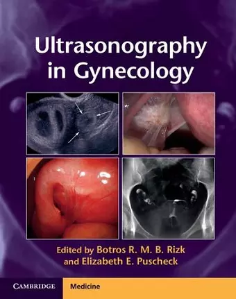 Ultrasonography in Gynecology cover