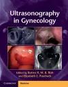 Ultrasonography in Gynecology cover