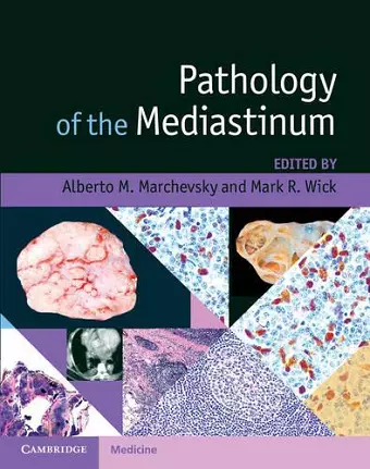 Pathology of the Mediastinum cover