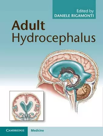 Adult Hydrocephalus cover