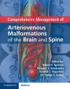Comprehensive Management of Arteriovenous Malformations of the Brain and Spine cover