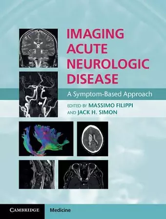 Imaging Acute Neurologic Disease cover