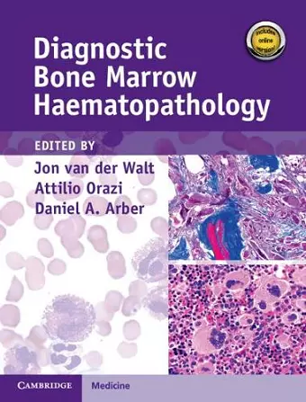 Diagnostic Bone Marrow Haematopathology Book with Online content cover