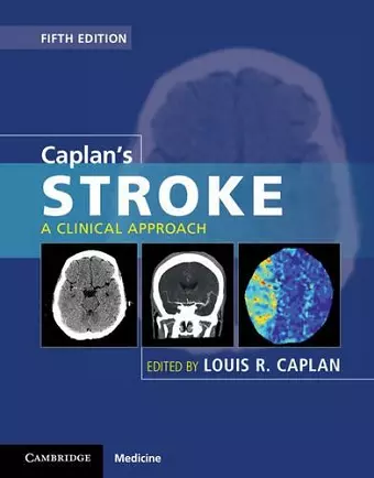 Caplan's Stroke cover