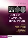 Fetal and Neonatal Brain Injury cover