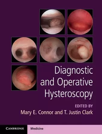 Diagnostic and Operative Hysteroscopy cover